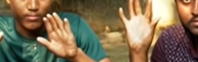 Svi se šokiraju kada ih vide, ali oni plaćaju visoku cenu