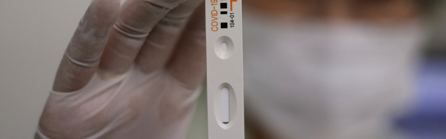 DONACIJA FARMACEUTA: Tri i po miliona za nabavku testova na COVID-19