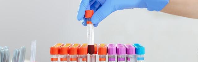 Rezerve krvi na minimumu: Jedinica ima za jedan dan, fale sve krvne grupe