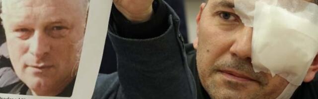 UŽAS U ARANĐELOVCU! Blokaderi urnisali čoveka - ZADOBIO TEŠKU POVREDU OKA, LEKARI SE BORE DA MU SPASU VID! (FOTO, VIDEO)