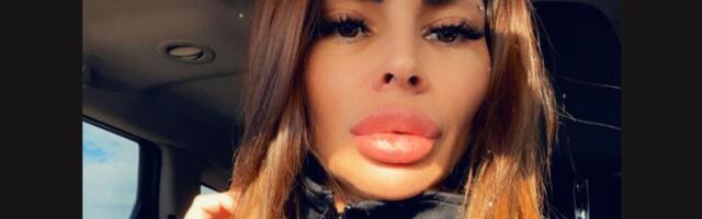 Jovanu partner ostavio u visokorizičnoj trudnoći, ona otkrila kroz šta prolazi "Dobijam jake injekcije..."