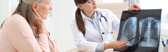 HILJADE SUGRAĐANA PROŠLO SKRINING, KLJUČNE PROMENE OTKRIVENE KOD 3 ODSTO LJUDI! Stjepanović o daljem toku lečenja raka pluća za Kurir: "OVO još koči lečenje..."