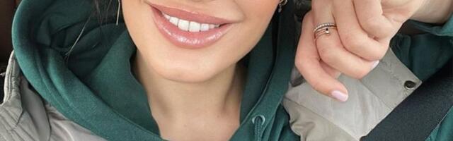 Tamara Ćosić bez filtera: Sve estetske i neinvazivne tretmane koje je radila na svom licu otkriva javno