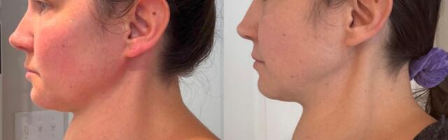 Zvali su je "ŽENA ŽABA", godinama su lekari ignorisali strašnu dijagnozu: "Niko me nije slušao!"