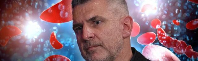 Hematolog objasnio kada je ANEMIJA opasna i kako se leči: Ovo su prvi simptomi koji ukazuju da imate problem
