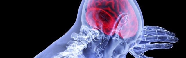 Neverovatno otkriće holandskih doktora: U glavi pronašli novi organ