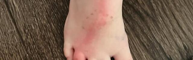 Sinu sam skinula čarapicu i videla crvenu liniju duž stopala, a onda sam uočila nešto što me je prestravilo (foto)