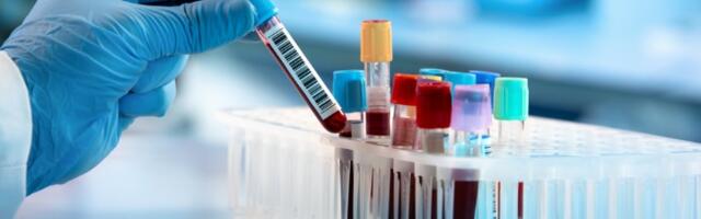 Naučnici potvrdili: Oboljevanje od korone zavisi od krvne grupe