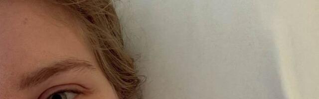 Poljakinja objavila prve fotografije nakon jezive povrede: Klizaljka joj prešla preko lica, umalo ostala bez oka! /FOTO/