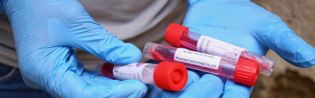 AMERIČKA UPRAVA ZA LEKOVE PRIZNALA: PCR test nije pouzdan, odobrenja se daju po hitnom postupku