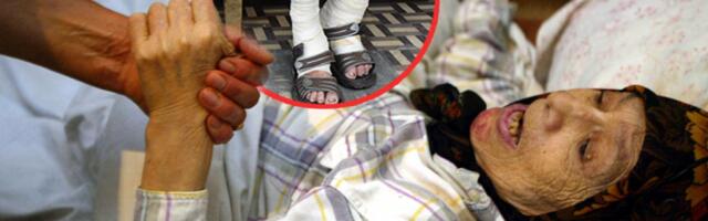 VRATILA SE GUBA U EVROPU! Zaboravljena bolest pred vratima Srbije!