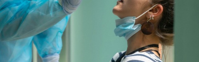 "Cena testa ne bi trebalo da bude veća od 3.000"