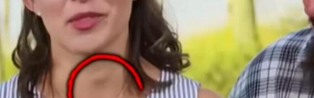 OVA ŽENA SA SLIKE JE IMALA OPASAN ZNAK RAKA GRLA, A DA NIJE ZNALA: Doktor gledao TV i odmah uočio signal! (VIDEO)
