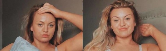 Influenserka koja svakodnevno pokazuje strije i celulit bi trebalo da bude lekcija svim ženama