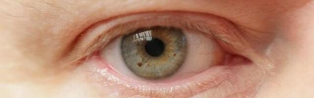 Povučeno više od 3 miliona bočica kapi za oči! Pune su bakterija i gljivica, ako ih imate, odmah ih bacite!