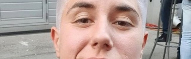 MATORA OTIŠLA POD NOŽ! Pogledajte kakvu PROMENU JE NAPRAVILA NA LICU - BOMBA! Posetila plastičara, rešila da se SREDI SKROZ! (FOTO)