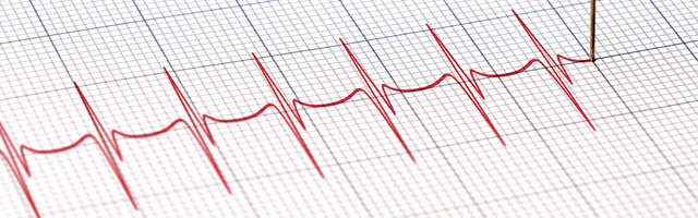 Koliko možemo da verujemo poligrafu?