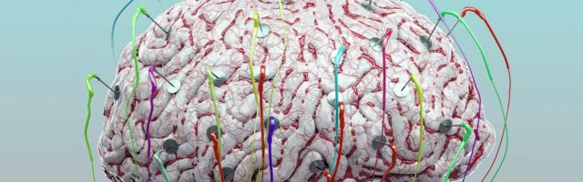 Može li tehnologija da pomogne da se ‘pokrene’ mozak