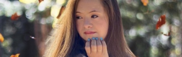 Upornost se isplati: Ona je model sa Daunovim sindromom