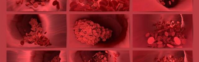 SRČANI I MOŽDANI UDAR MOGU SE IZBEĆI!  Evo kako osetiti krvni ugrušak, a ovo je situacija kad treba potražiti urgentnu pomoć!