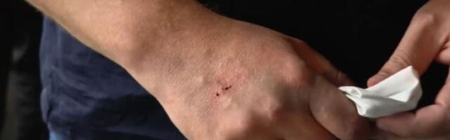 Ovako je predsednika "napalo" staklo (VIDEO)