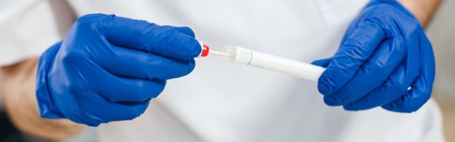 Još 116 novozaraženih, 8 osoba preminulo