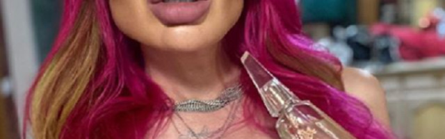 Anastasija ima NAJVEĆE OBRAZE NA SVETU, ali smatra da to nije dovoljno (FOTO)