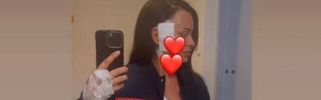 "Rezali mi kosti i stavljali... "Jelena imala tešku operaciju nakon dijagnoze raka: "Rekli su mi da…"