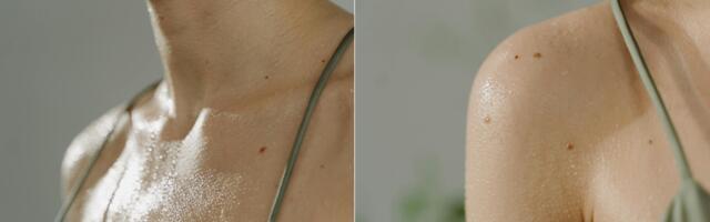 Prekomereno znojenje je vaša svakodnevnica? Možda je ovo stanje uzrok