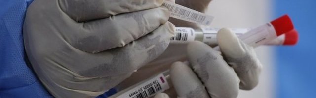 ŠEF KANCELARIJE SVETSKE ZDRAVSTVENE ORGANIZACIJE U SRBIJI IZRAZIO ZABRINUTOST! Zadovoljan testovima, plaši ga broj zaraženih