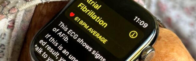 Apple Watch će biti povezan sa 5G