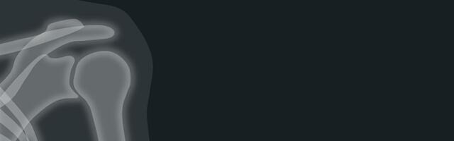 Na današnji dan: Rentgen otkrio x-zrake