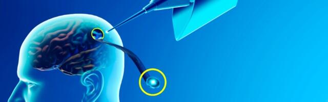 Moždani implanti Elona Maska neće biti testirani na ljudima