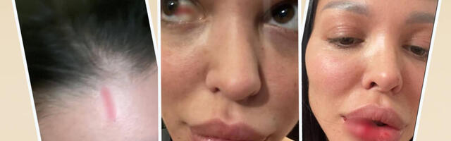 MAJA MARINKOVIĆ CELA KRVAVA, U PODLIVIMA I MODRICAMA Objavila jezive fotografije, pa optužila Filipa Cara: "Do sada sam ćutala"
