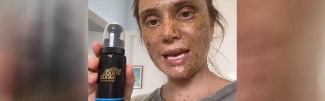 "Koristila sam sredstvo za samopotamnjivanje i pogledajte šta mi se desilo" Više od 20 miliona ljudi u šoku od prizora: Oglasio se i brend (VIDEO)