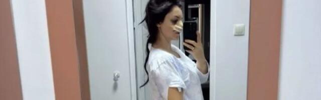 Operisana zvezda Granda! Pola lica joj natečeno i u zavojima, oglasila se