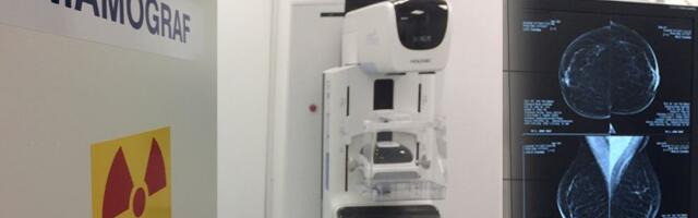 Ove nedelje stiže ultrazvučni aparat, a potom i digitalni mamograf!