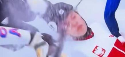 OŠTRICA KLIZALJKE JOJ PREREZALA LICE - KRV LILA NA SVE STRANE! Detalji stravične povrede klizačice na ZOI: Naočare joj spasle oko! (UZNEMIRIJUĆI VIDEO)