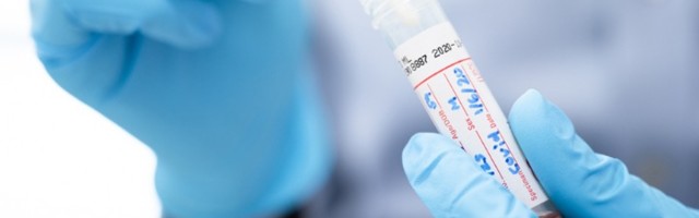 U CG novih 289 slučajeva, preminule tri osobe