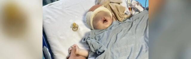 Tata Luka vrisnuo, babica pretrnula od šoka na porođaju: Ovom mališanu su četiri meseca bile zašivene oči