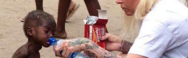 DEČAK ZBOG KOG JE PLAKAO CEO SVET! Bio je ostavljen da umre, a danas ga niko ne bi prepoznao! /FOTO/