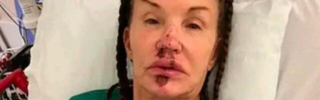 TRAJNO UNAKAŽENA? U Jugoslaviji je OBOŽAVALI, a sad je ne bi prepoznali - LICE JOJ UNIŠTENO, HIRURZI BESPOMOĆNI