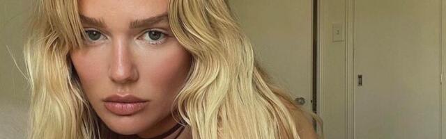 Može li hijaluronska kiselina naštetiti vašoj koži? 3 saveta koje treba da znate