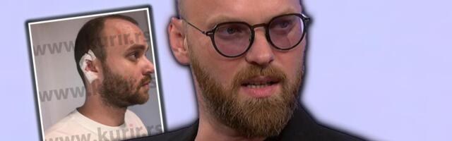 PEVAČU GOST NA NASTUPU ODGRIZAO UVO! On sada otvorio dušu: Imao sam traume