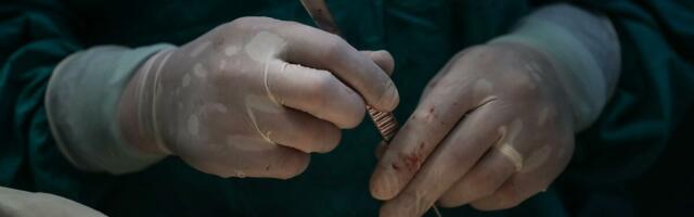 Urađena prva transplantacija pluća u našoj zemlji: Istorijski poduhvat lekara UKC Srbije!