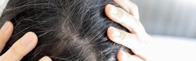 Da li treba čupati sede dlake? Frizeri upozoravaju na greške koje mogu uništiti vašu kosu