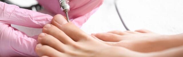 Šta je medicinski pedikir i zašto vaša stopala zaslužuju ovaj tretman