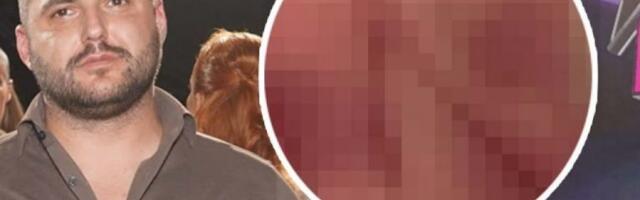 GROZNO! POJAVILI MU SE MODRI PEČATI PO TELU! Uznemirujuć snimak Asmina Durdžića! (FOTO)