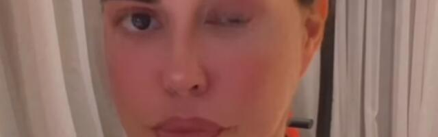 "Nemam više funkciju leve strane, ne čujem, niti vidim": Dijana Diline prolazi agoniju nakon nesreće