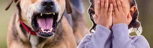 VLASNIČKI PAS IZUJEDAO PETOGODIŠNJU DEVOJČICU PO LICU I TELU! Dete zadobilo teže telesne povrede, evo šta je dovelo do stravičnog napada